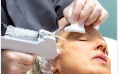 Mesotherapie
